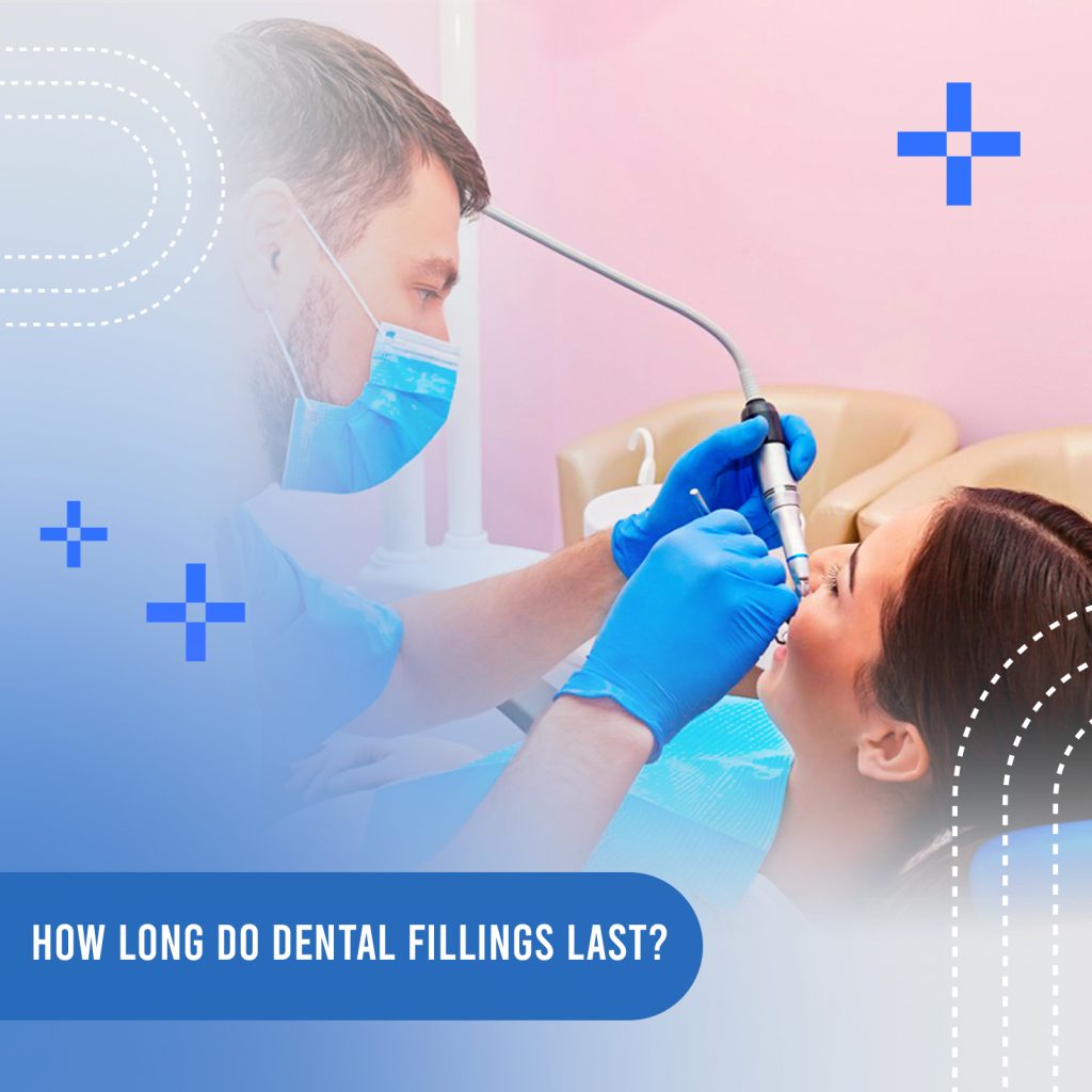 How long do dental fillings last?