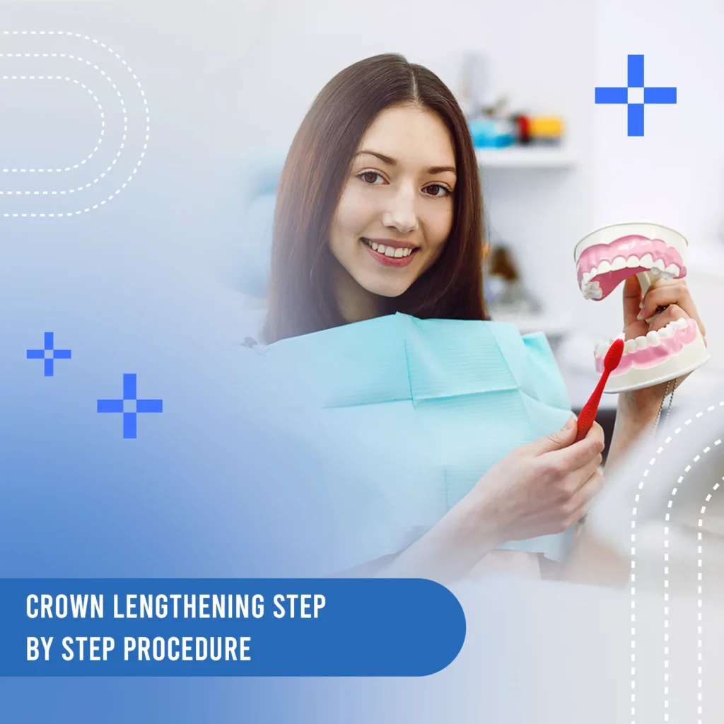 crown lengthening a step by step procedure