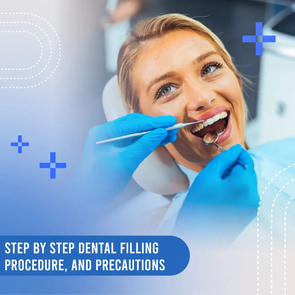 step by step dental filling procedure