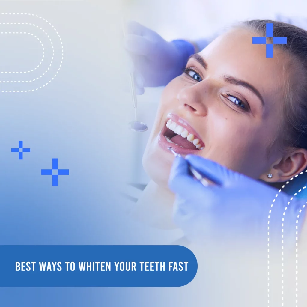 Best ways to whiten your teeth fast