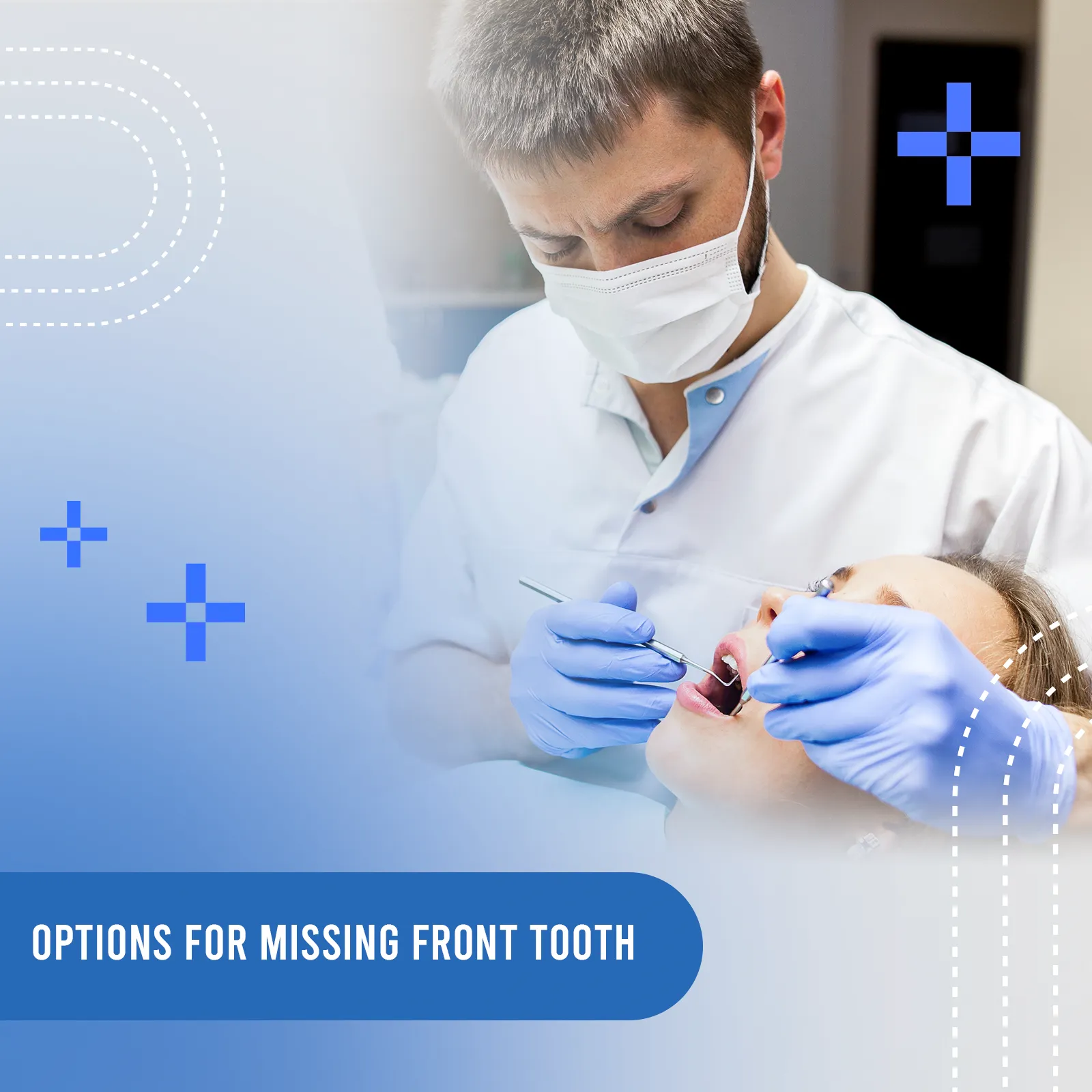 options for missing front tooth