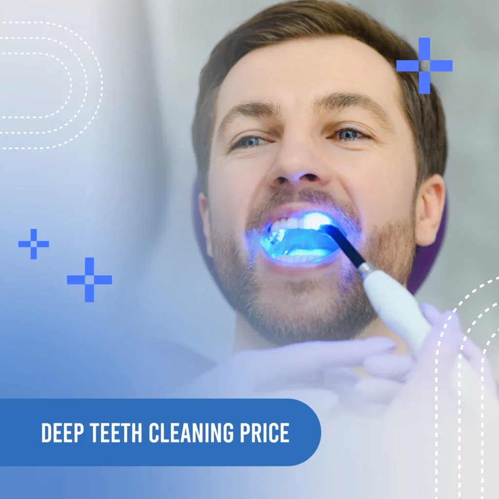 deep cleaning teeth price