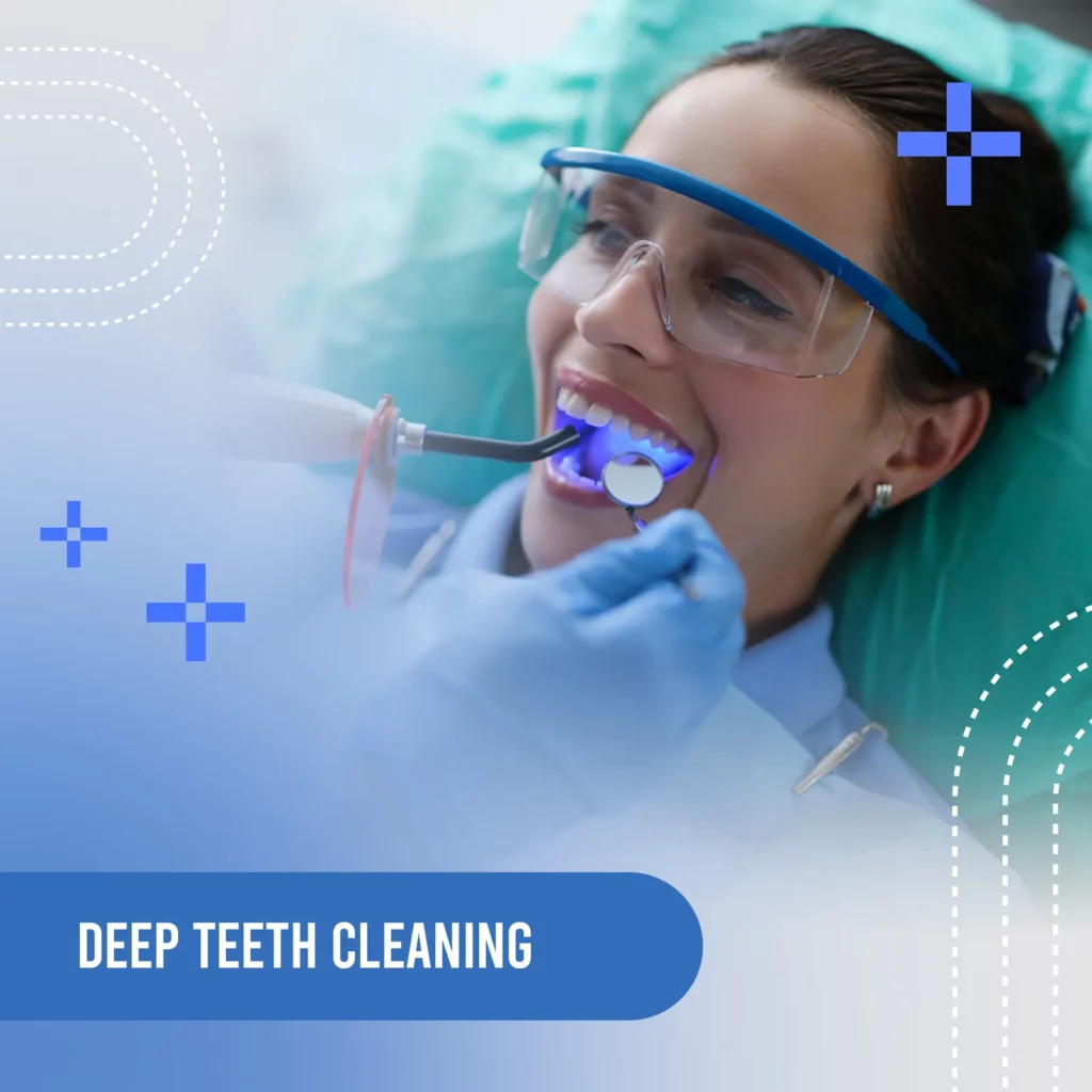 Deep teeth cleaning