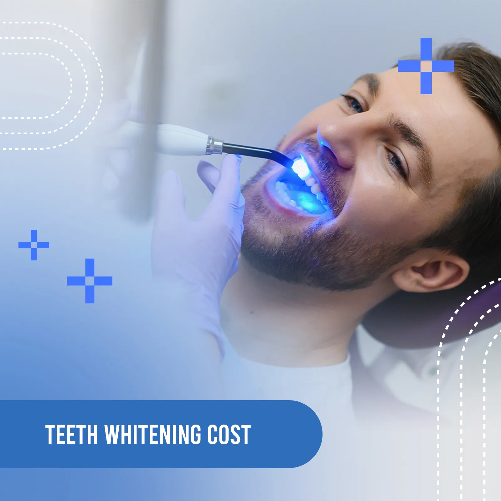 teeth whitening cost