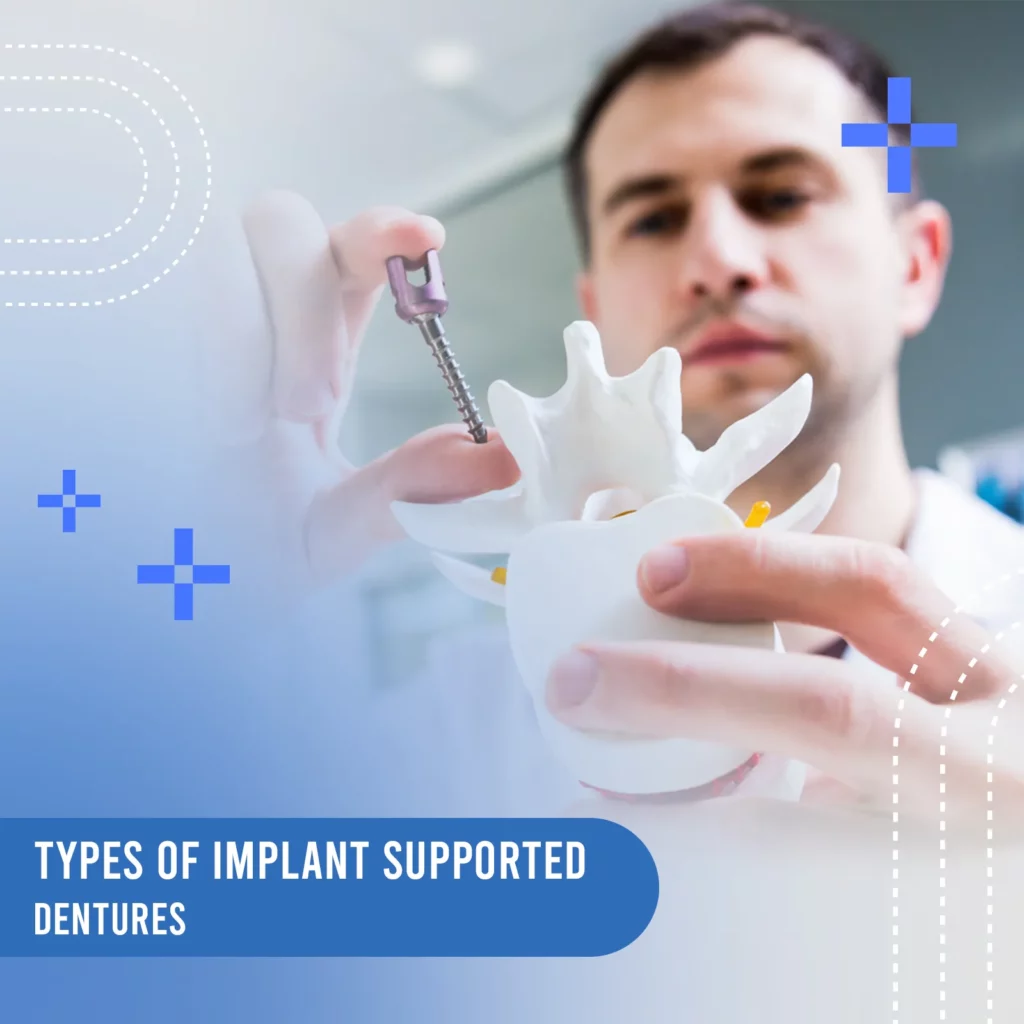 types of implant supported dentures_9_11zon