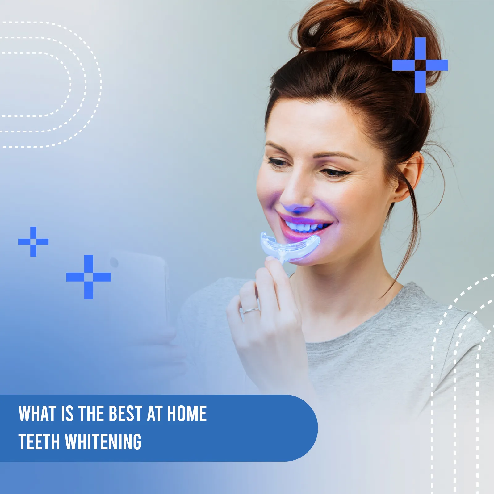 what is the best at home teeth whitening